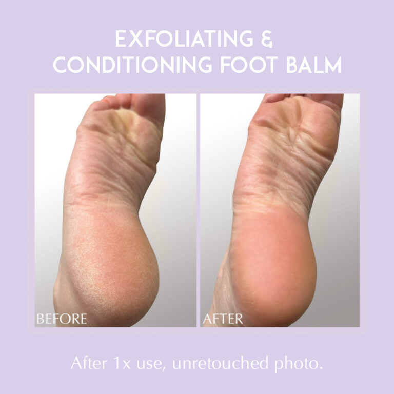 Bilde for sosiale medier Exuviance Exfoliating & Conditioning Foot Balm 1