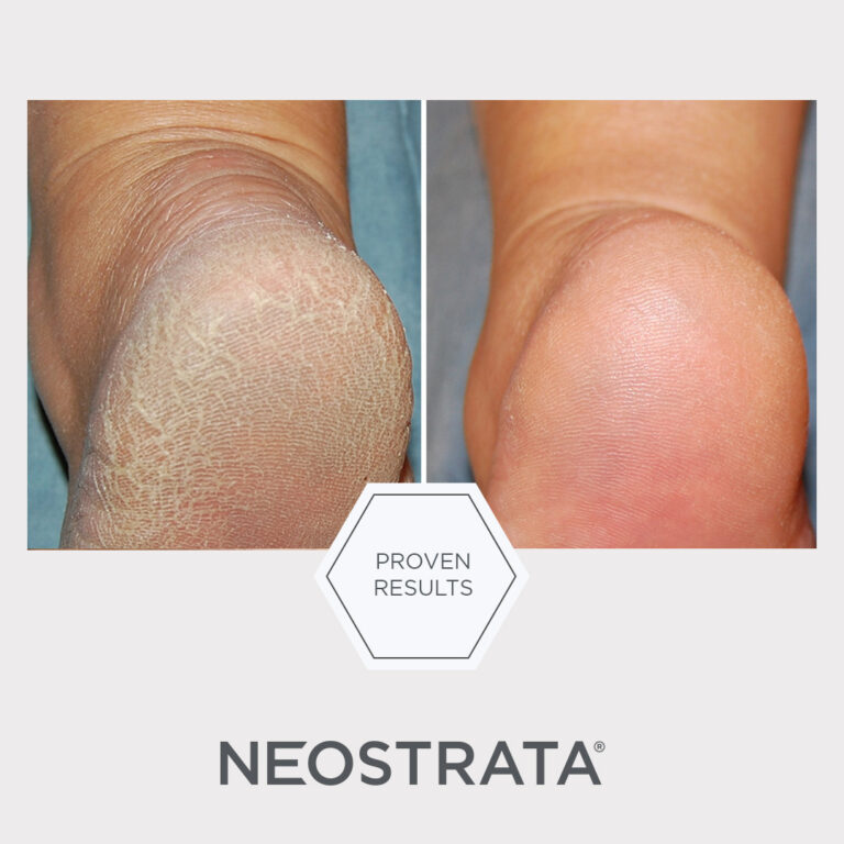 Bilde for sosiale medier NEOSTRATA Problem Dry Skin Cream 1
