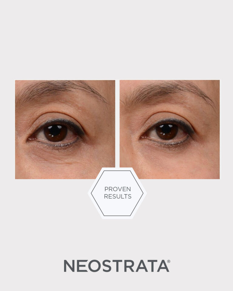 Bilde for sosiale medier NEOSTRATA Intensive Eye Therapy 1