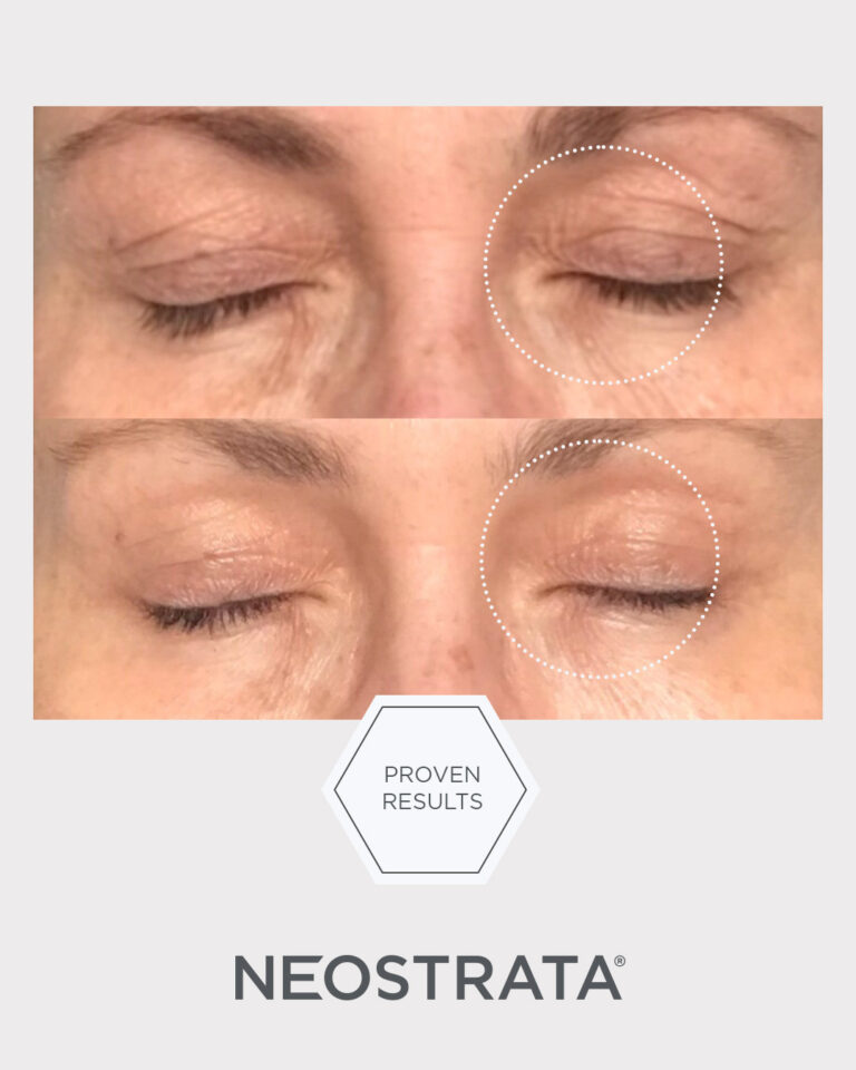 Bilde for sosiale medier NEOSTRATA Intensive Eye Therapy 7