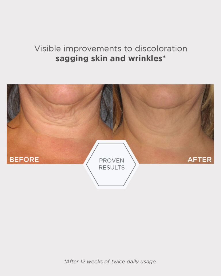 Bilde for sosiale medier NEOSTRATA Triple Firming Neck Cream 4