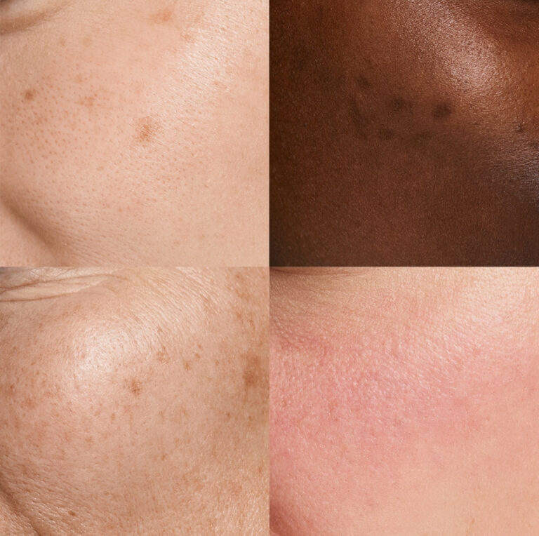 Bilde for sosiale medier NEOSTRATA hud