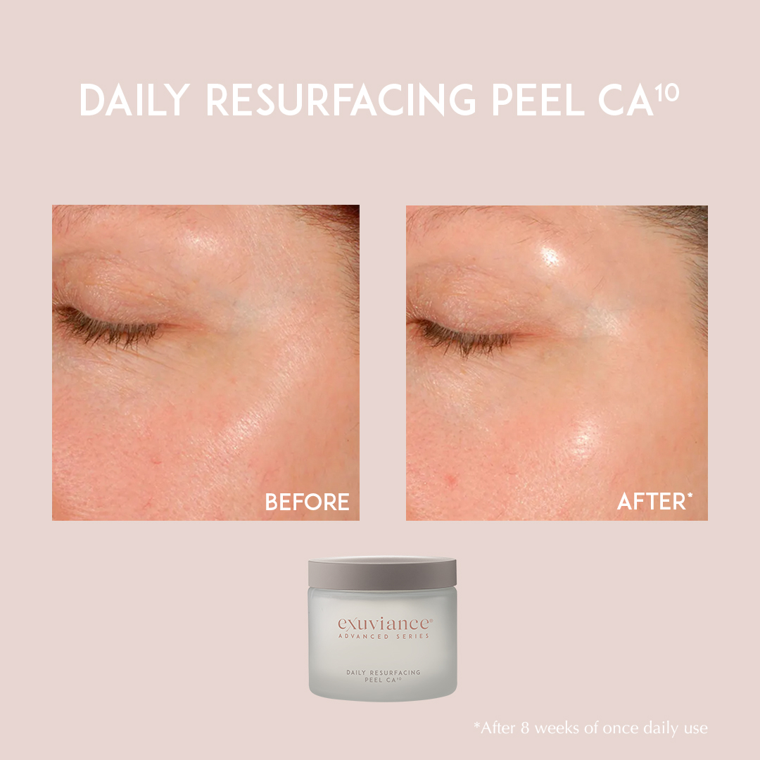 Bilde for sosiale medier Exuviance Daily Resurfacing Peel CA10 2