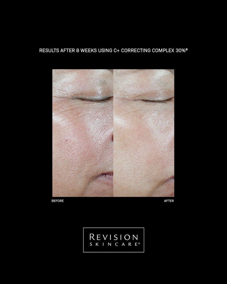 Bilde for sosiale medier Revision Skincare C Correcting
